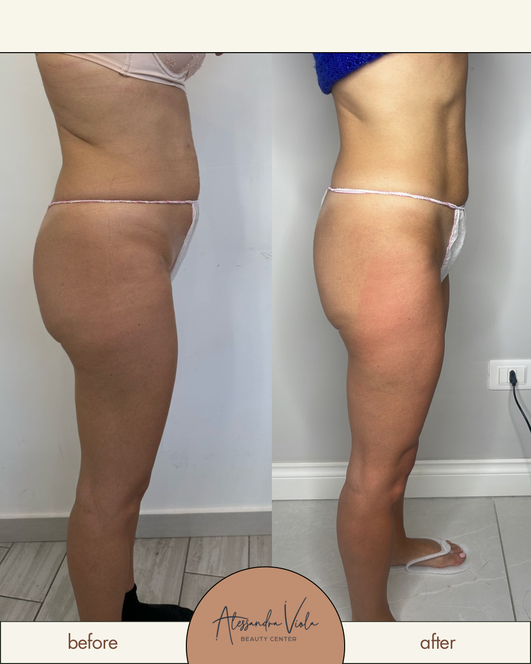 Metodo Alessandra Viola