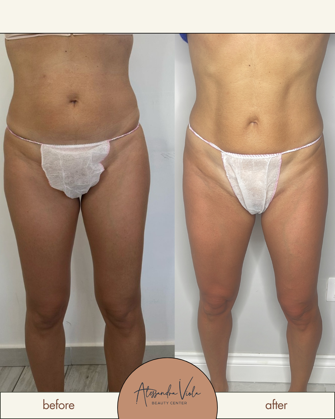 Metodo Alessandra Viola