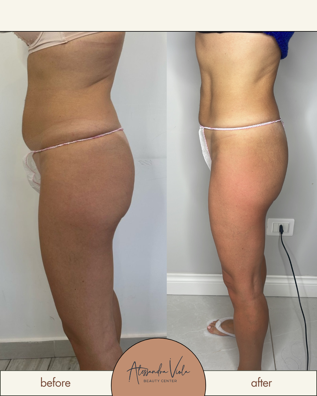 Metodo Alessandra Viola